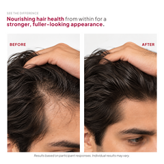 Hair Boost Vitamins