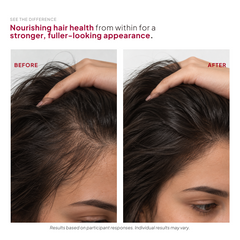 Hair Boost Vitamins